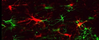 neurodevelopment.jpg
